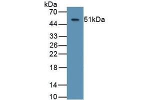 Detection of Recombinant ASPH, Human using Monoclonal Antibody to Aspartate Beta Hydroxylase (ASPH) (Aspartate beta Hydroxylase Antikörper  (AA 345-758))