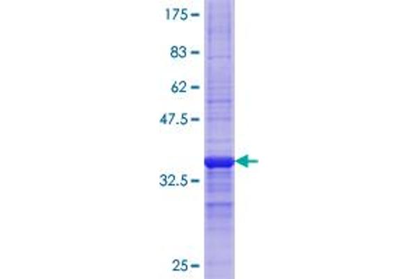 CPT1A Protein (AA 461-550) (GST tag)