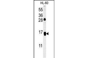 Western blot analysis in HL-60 cell line lysates (35ug/lane). (CD69 Antikörper  (AA 119-148))