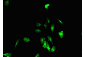 Immunofluorescent analysis of Hela cells using ABIN7151870 at dilution of 1:100 and Alexa Fluor 488-congugated AffiniPure Goat Anti-Rabbit IgG(H+L) (EPH Receptor B6 Antikörper  (AA 410-553))