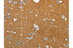 The image on the left is immunohistochemistry of paraffin-embedded Human brain tissue using ABIN7192659(SSTR4 Antibody) at dilution 1/25, on the right is treated with synthetic peptide. (SSTR4 Antikörper)