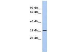 Image no. 1 for anti-Calcium Channel, Voltage-Dependent, gamma Subunit 6 (CACNG6) (N-Term) antibody (ABIN6742567) (CACNG6 Antikörper  (N-Term))
