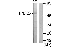 Immunohistochemistry analysis of paraffin-embedded human brain tissue using IP6K3 antibody.