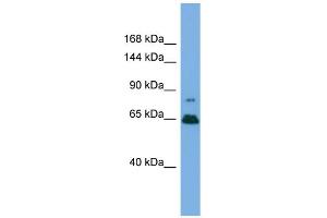 Western Blotting (WB) image for anti-Zinc Finger Protein 676 (ZNF676) (Middle Region) antibody (ABIN2787553) (ZNF676 Antikörper  (Middle Region))