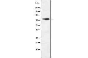 Western blot analysis FAKD2 using HeLa whole cell lysates (FASTKD2 Antikörper  (Internal Region))