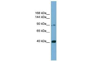 UNC5C antibody used at 1 ug/ml to detect target protein.