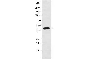 DOK6 Antikörper  (Internal Region)