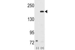 Western blot analysis of SRC-1 antibody and 293 cell lysate (2 ug/lane) either nontransfected (Lane 1) or transiently transfected with the NCOA1 gene (2). (NCOA1 Antikörper  (AA 186-214))