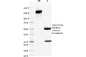 SDS-PAGE Analysis Purified AIF1 / Iba1 Mouse Monoclonal Antibody (AIF1/1909). (Iba1 Antikörper  (AA 1-146))