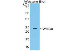 Western blot analysis of the recombinant protein. (IFNB1 Antikörper  (AA 22-187))