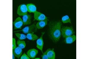 IF analysis of Visfatin/NAMPT using anti-Visfatin/NAMPT antibody (ABIN4886677). (NAMPT Antikörper  (AA 62-337))