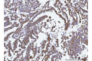 IHC analysis of GLUD1/2 using anti-GLUD1/2 antibody (ABIN7602000). (GLUD1 / GLUD2 (AA 54-553) Antikörper)