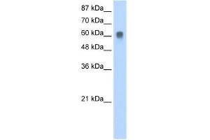WB Suggested Anti-ZFP91 Antibody Titration:  0. (ZFP91 Antikörper  (N-Term))