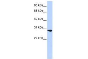 Image no. 1 for anti-Fibroblast Growth Factor 2 (Basic) (FGF2) (C-Term) antibody (ABIN6743086) (FGF2 Antikörper  (C-Term))