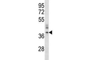 CRACM1 antibody western blot analysis in A375 lysate.