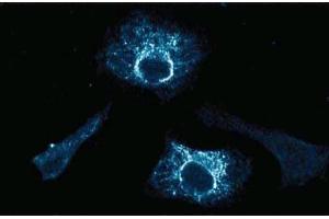 Immunofluorescence staining of HeLa cells (Human cervical epitheloid carcinoma, ATCC CCL-2. (HSP70 Antikörper  (AA 429-640))
