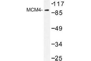 Image no. 1 for anti-Minichromosome Maintenance Deficient 4 (MCM4) antibody (ABIN317884) (MCM4 Antikörper)