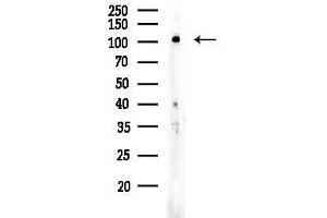 anti-Inositol Polyphosphate-5-Phosphatase J (INPP5J) (C-Term) antibody