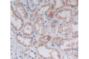 Immunohistochemistry (IHC) image for anti-Integrin-Linked Kinase (ILK) (AA 183-452) antibody (ABIN5013757)