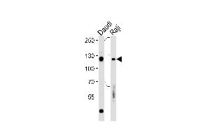 Rb Antibody  (ABIN1881730 and ABIN2840685) western blot analysis in Daudi,Raji cell line lysates (35 μg/lane). (Retinoblastoma 1 Antikörper  (AA 586-615))
