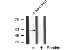 Western blot analysis of akt2 phosphorylation expression in mouse brain tissue lysates,The lane on the right is treated with the antigen-specific peptide. (AKT2 Antikörper  (pSer474))