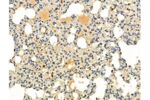 ABIN6255286 and ABIN6267647 at 1/100 staining Rat lung tissue by IHC-P. (IRF3 Antikörper  (pSer386))