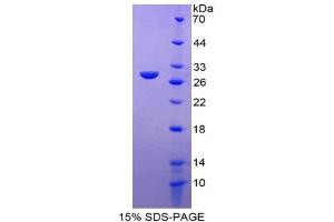 SDS-PAGE (SDS) image for Cardiac Troponin I (TNNI3) (AA 1-211) protein (His tag) (ABIN1980746)