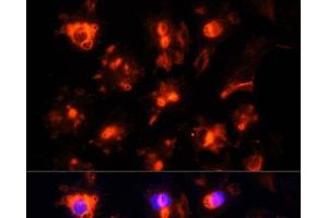 Immunofluorescence analysis of HUVEC cells using CD31 Polyclonal Antibody at dilution of 1:100. (CD31 Antikörper)