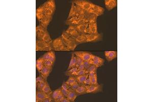 Immunofluorescence analysis of U2OS cells using PFKL antibody (ABIN7269308) at dilution of 1:100. (PFKL Antikörper  (AA 700-780))
