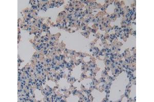 IHC-P analysis of Mouse Tissue, with DAB staining. (FABP5 Antikörper  (AA 2-135))