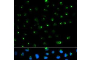 Immunofluorescence analysis of MCF-7 cells using PSAP Polyclonal Antibody (Prosaposin Antikörper)