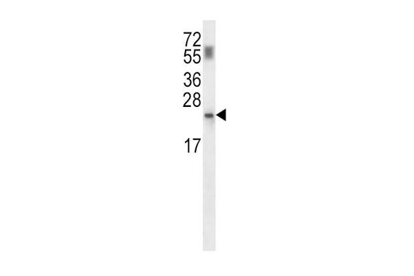 PPCDC Antikörper  (N-Term)