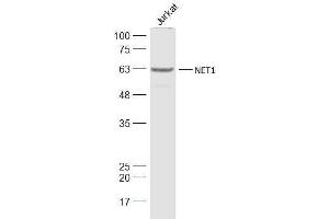 Jurkat lysates probed with NET1 Polyclonal Antibody, Unconjugated  at 1:1000 dilution and 4˚C overnight incubation.