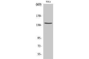 Western Blot (WB) analysis of specific cells using Cleaved-Spectrin alpha II (D1185) Polyclonal Antibody.