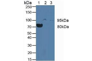 Western blot analysis of (1) Rat Blood Cells, (2) Human JAR Cells and (3) Human Placenta Tissue. (CSF3R Antikörper  (AA 26-138))