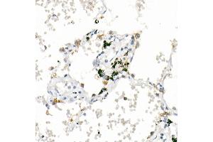 Immunohistochemistry of paraffin-embedded human lung using  Rabbit mAb (ABIN7265424) at dilution of 1:1000 (40x lens). (ACSL4 Antikörper)