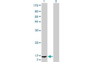 Western Blot analysis of FABP1 expression in transfected 293T cell line by FABP1 monoclonal antibody (M02A), clone 5F7. (FABP1 Antikörper  (AA 1-127))