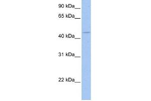 WB Suggested Anti-SOX8 Antibody Titration:  0. (SOX8 Antikörper  (C-Term))