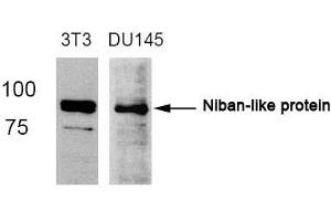 Western Blotting (WB) image for anti-Family with Sequence Similarity 129, Member B (FAM129B) (AA 710-714) antibody (ABIN363056) (MEG3 Antikörper  (AA 710-714))