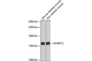 Western blot analysis of extracts of various cell lines, using MYBPC2 antibody (ABIN6129608, ABIN6144218, ABIN6144220 and ABIN6222676) at 1:1000 dilution. (MYBPC2 Antikörper  (AA 912-1141))