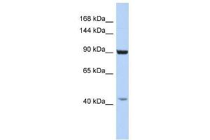 GRIP1 antibody used at 2. (GRIP1 Antikörper  (C-Term))