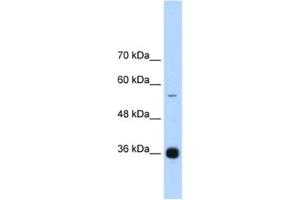 Western Blotting (WB) image for anti-Heterogeneous Nuclear Ribonucleoprotein A/B (HNRNPAB) antibody (ABIN2462311) (HNRNPAB Antikörper)