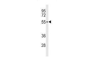 Western blot analysis of ACCN1 Antibody (Center) (ABIN653161 and ABIN2842729) in NCI- cell line lysates (35 μg/lane). (ACCN1 Antikörper  (AA 120-148))