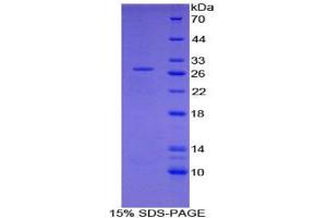 SDS-PAGE analysis of Mouse Nucleoporin 98 kDa Protein. (NUP98 Protein)