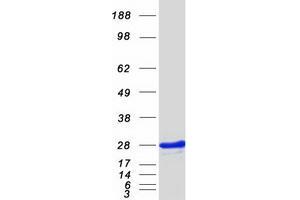 Western Blotting (WB) image for Inosine Triphosphatase (ITPA) (Transcript Variant 1) protein (Myc-DYKDDDDK Tag) (ABIN2723911)