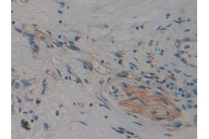 Immunohistochemistry (IHC) image for anti-Caspase Recruitment Domain Family, Member 9 (CARD9) (AA 26-283) antibody (ABIN7443479)