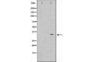 Western blot analysis on HuvEc cell lysate using APC Antibody,The lane on the left is treated with the antigen-specific peptide. (APC Antikörper  (Internal Region))