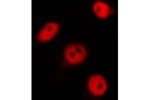 Immunofluorescence (fixed cells) (IF/ICC) image for anti-Heterogeneous Nuclear Ribonucleoprotein C (C1/C2) (HNRNPC) (C-Term) antibody (ABIN6262317)