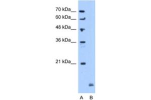 Western Blotting (WB) image for anti-Crystallin, alpha B (CRYAB) antibody (ABIN2463152) (CRYAB Antikörper)