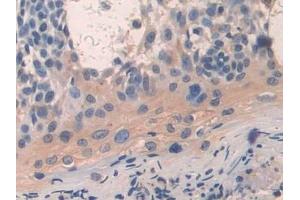 Immunohistochemistry (IHC) image for anti-Arrestin, beta 1 (ARRB1) (AA 3-246) antibody (ABIN7441790)